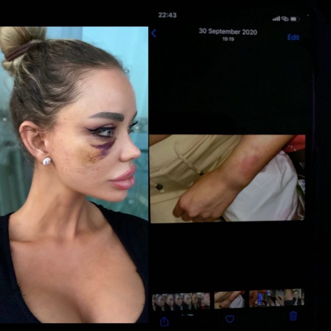 Bianca Drăguşanu, agresată